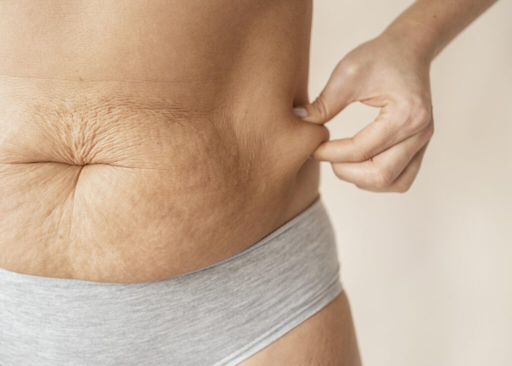 Cirurgia de remoção de pele.