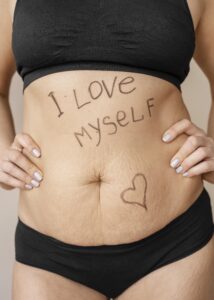 Imagem ilustrativa. Barriga de avental: plano cobre cirurgia.